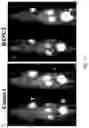 Fig. 12 - PEPTIDE PET/SPECT PROBES SPECIFIC TO ONCOPROTEINS IN TUMOR EXTRACELLULAR MATRIX