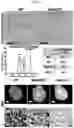 Fig. 06 - Compositions of and methods of making ferritin-based imaging agents