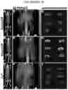 Fig. 07 - Compositions of and methods of making ferritin-based imaging agents