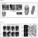 Fig. 07 - TISSUE FUSION COMPOSITION HAVING TISSUE ADHESION AND DIFFERENTIATION CHARACTERISTICS, AND PREPARATION METHOD THEREFOR