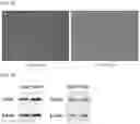 Fig. 12 - TISSUE FUSION COMPOSITION HAVING TISSUE ADHESION AND DIFFERENTIATION CHARACTERISTICS, AND PREPARATION METHOD THEREFOR