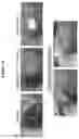 Fig. 26 - Solution Blow Spun Polymer Constructs, Compositions and Methods of Fabrications and Uses Relating Thereto