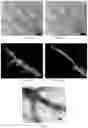Fig. 04 - PREPARATION METHOD FOR NON-SPHERICAL HYDROGEL MICROPARTICLE EMBOLIC AGENT
