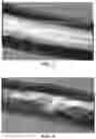 Fig. 03 - HYALURONATE FIBER AND MANUFACTURING METHOD THEREOF
