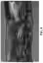 Fig. 04 - HYALURONATE FIBER AND MANUFACTURING METHOD THEREOF