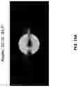 Fig. 25 - Chitosan nanofiber compositions, compositions comprising modified chitosan, and methods of use