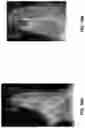 Fig. 29 - Chitosan nanofiber compositions, compositions comprising modified chitosan, and methods of use