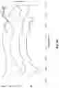 Fig. 41 - Chitosan nanofiber compositions, compositions comprising modified chitosan, and methods of use