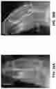 Fig. 67 - Chitosan nanofiber compositions, compositions comprising modified chitosan, and methods of use