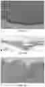Fig. 09 - RAPID ALLOGRAFT TREATMENT SYSTEMS AND METHODS