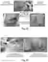 Fig. 21 - SELF-ASSEMBLING PEPTIDES AS BRONCHIAL OBSTRUCTION AGENTS