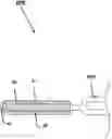 Fig. 01 - AN ATTACHMENT MEANS FOR ATTACHING A MEDICAL DEVICE TO TISSUE, A SYSTEM FOR ATTACHING A MEDICAL DEVICE TO TISSUE, A MEDICAL DEVICE HAVING AN ATTACHMENT MEANS, A METHOD OF ATTACHING A MEDICAL DEVICE TO TISSUE, AND A METHOD OF MANUFACTURING AN ATTACHMENT MEANS