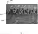 Fig. 11 - AN ATTACHMENT MEANS FOR ATTACHING A MEDICAL DEVICE TO TISSUE, A SYSTEM FOR ATTACHING A MEDICAL DEVICE TO TISSUE, A MEDICAL DEVICE HAVING AN ATTACHMENT MEANS, A METHOD OF ATTACHING A MEDICAL DEVICE TO TISSUE, AND A METHOD OF MANUFACTURING AN ATTACHMENT MEANS