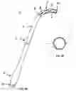 Fig. 03 - Arterial cannula