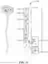 Fig. 15 - Methods of Amelioration of Cerebrospinal Fluid and Devices and Systems Therefor