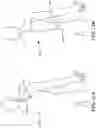 Fig. 16 - Methods of Amelioration of Cerebrospinal Fluid and Devices and Systems Therefor
