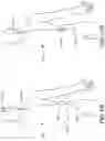 Fig. 17 - Methods of Amelioration of Cerebrospinal Fluid and Devices and Systems Therefor