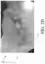 Fig. 17 - Negative pressure wound treatment apparatuses and methods with integrated electronics