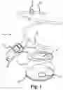Fig. 02 - An anal irrigation system and related methods for maintaining