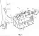 Fig. 02 - Flushing a fluid line from a medical pump