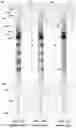 Fig. 02 - SYRINGE BARREL WITH IMPROVED SCALE PRESENTATION