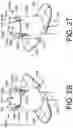 Fig. 21 - DEVICES AND METHODS FOR PRECISION DOSE DELIVERY