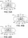 Fig. 84 - DEVICES AND METHODS FOR PRECISION DOSE DELIVERY