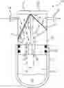 Fig. 01 - Apparatus and method for filtering liquid particles from inspiratory gas flow of a patient breathing circuit affiliated with a ventilator and/or nitric oxide delivery system