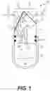 Fig. 02 - Apparatus and method for filtering liquid particles from inspiratory gas flow of a patient breathing circuit affiliated with a ventilator and/or nitric oxide delivery system