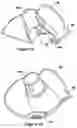 Fig. 12 - RESPIRATORY ASSISTANCE APPARATUS