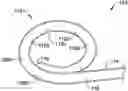 Fig. 01 - RADIOPAQUE MARKER AND DELIVERY SYSTEM