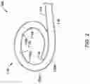 Fig. 03 - RADIOPAQUE MARKER AND DELIVERY SYSTEM