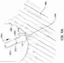 Fig. 07 - RADIOPAQUE MARKER AND DELIVERY SYSTEM