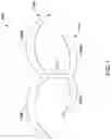 Fig. 10 - RADIOPAQUE MARKER AND DELIVERY SYSTEM