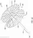 Fig. 13 - RADIOPAQUE MARKER AND DELIVERY SYSTEM