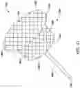 Fig. 14 - RADIOPAQUE MARKER AND DELIVERY SYSTEM