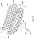 Fig. 15 - RADIOPAQUE MARKER AND DELIVERY SYSTEM