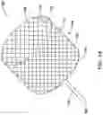 Fig. 17 - RADIOPAQUE MARKER AND DELIVERY SYSTEM