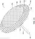 Fig. 18 - RADIOPAQUE MARKER AND DELIVERY SYSTEM