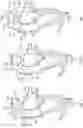 Fig. 04 - CATHETER CLAMPING DEVICE