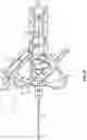 Fig. 06 - INTRAVENOUS CATHETER SYSTEMS AND METHODS