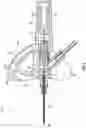 Fig. 07 - INTRAVENOUS CATHETER SYSTEMS AND METHODS