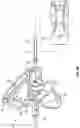 Fig. 09 - INTRAVENOUS CATHETER SYSTEMS AND METHODS