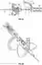 Fig. 13 - INTRAVENOUS CATHETER SYSTEMS AND METHODS
