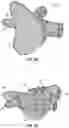 Fig. 28 - INTRAVENOUS CATHETER SYSTEMS AND METHODS