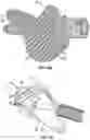 Fig. 33 - INTRAVENOUS CATHETER SYSTEMS AND METHODS