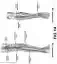 Fig. 02 - PERIPHERAL ARTERY BALLOON, A HYPO-TUBE FOR PREPARING A PERIPHERAL ARTERY BALLOON AND METHODS OF USE THEREOF