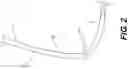 Fig. 04 - PERIPHERAL ARTERY BALLOON, A HYPO-TUBE FOR PREPARING A PERIPHERAL ARTERY BALLOON AND METHODS OF USE THEREOF
