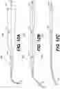 Fig. 17 - PERIPHERAL ARTERY BALLOON, A HYPO-TUBE FOR PREPARING A PERIPHERAL ARTERY BALLOON AND METHODS OF USE THEREOF