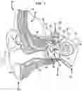 Fig. 02 - TREATMENT OF THE EAR